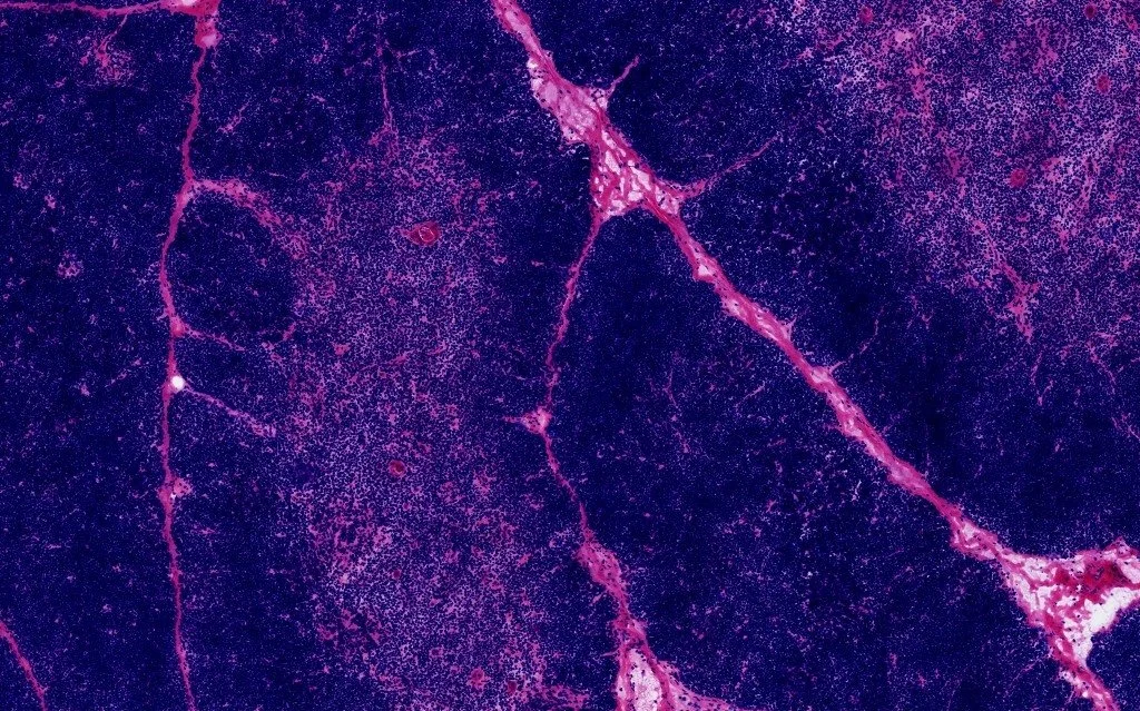 Research on Immune dynamics